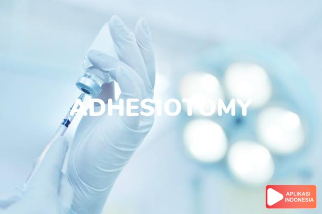 arti adhesiotomy adalah Operasi pemotongan adhesi. dalam kamus farmasi bahasa indonesia online by Aplikasi Indonesia